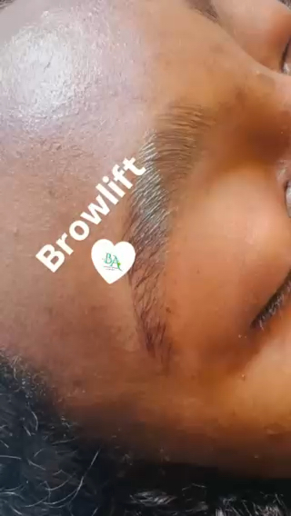 Vidéo Browlift chez Beaute Anto