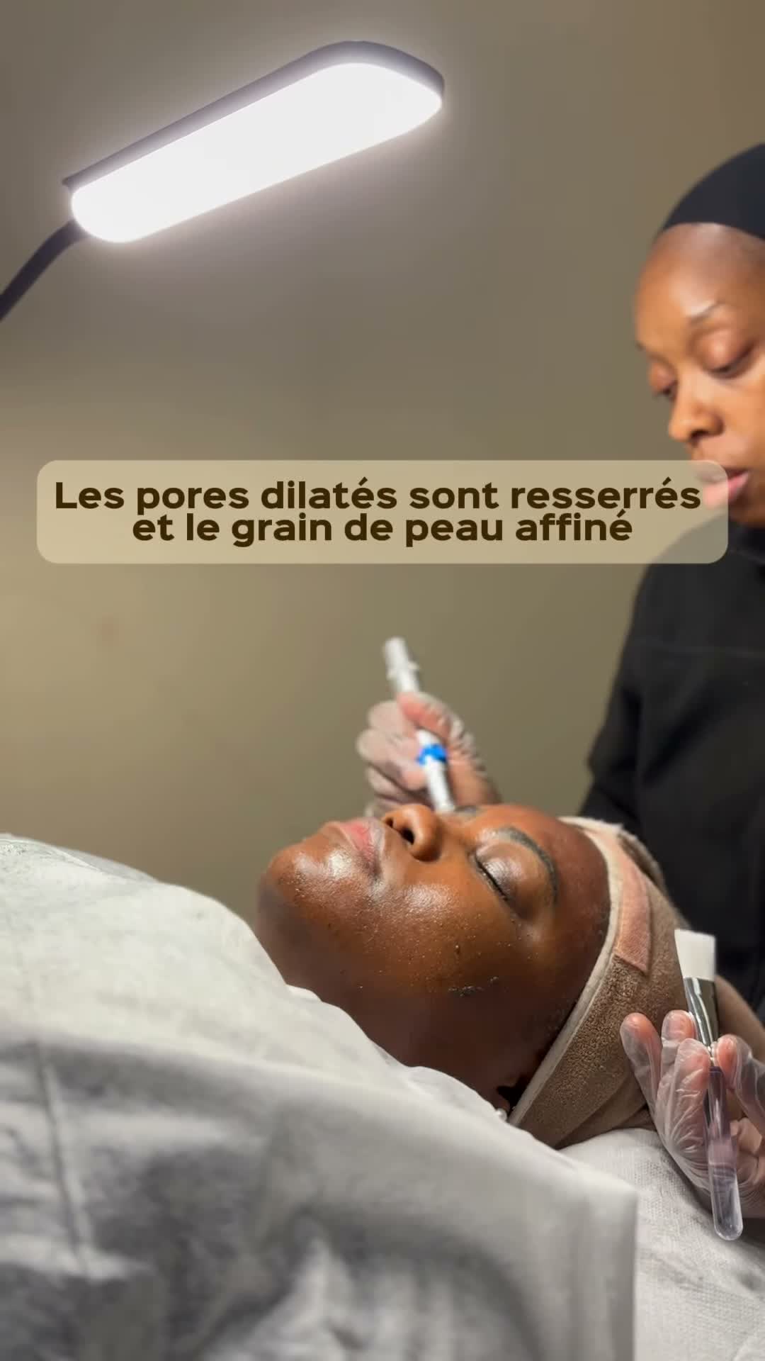 Vidéo Peeling + nanoneedling chez ABD Beauty