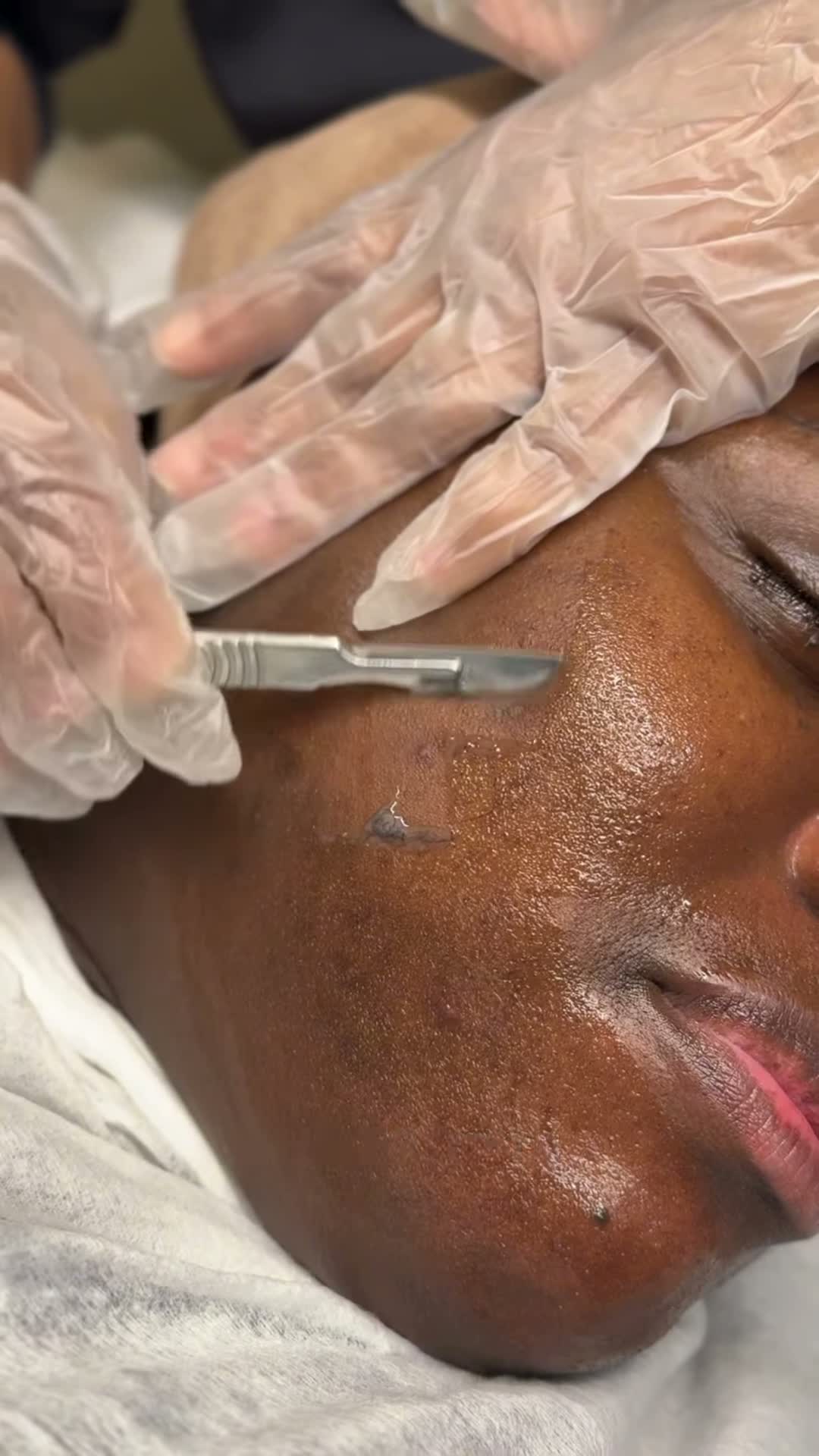 Vidéo Dermaplaning chez ABD Beauty