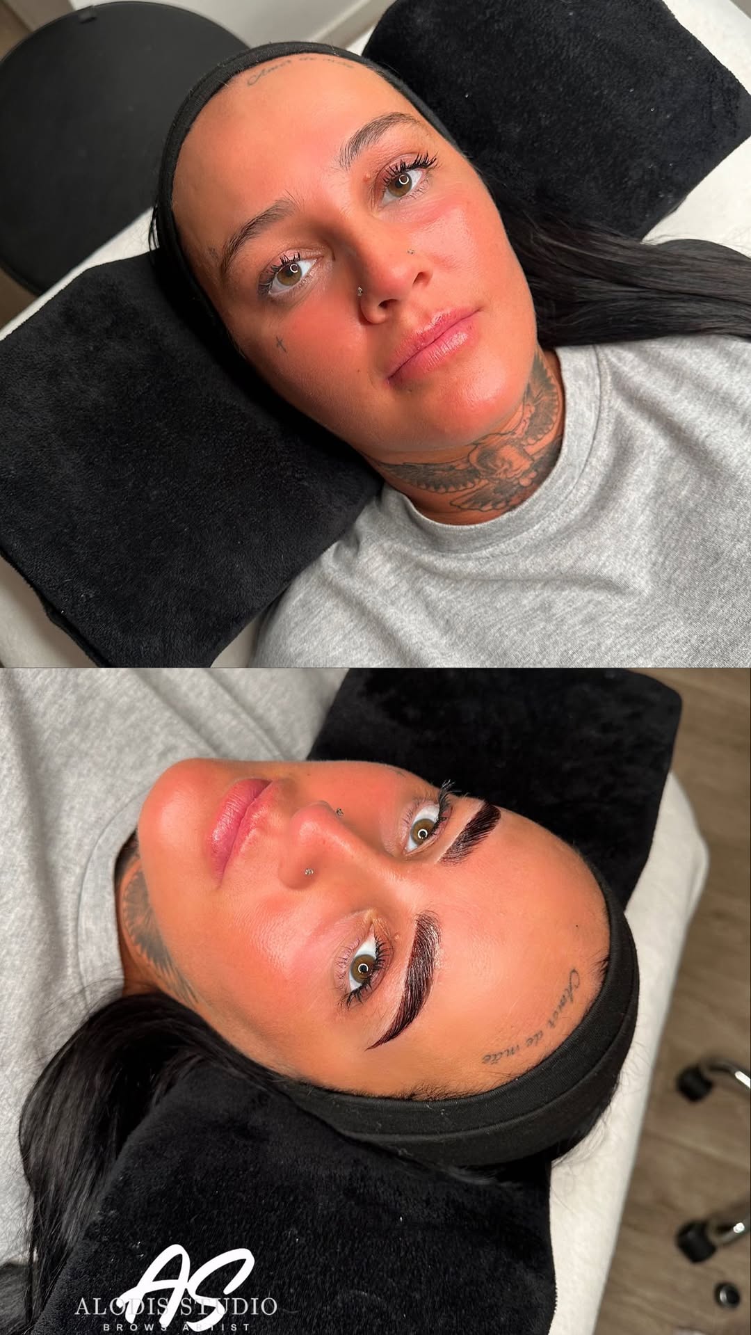 Vidéo Browlift simple chez Alodis Studio