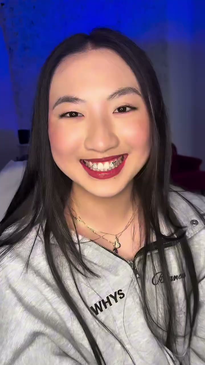 Vidéo Pose de strass dentaire composition illimité chez Smile To Slay