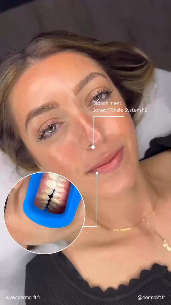 Vidéo Joues chez DERMOLIFT X 8BEAUTY