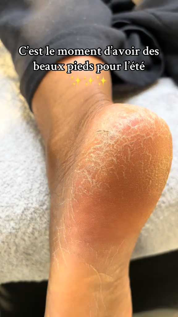 Vidéo Forfait rehaussement de cils chez Browlift by HK