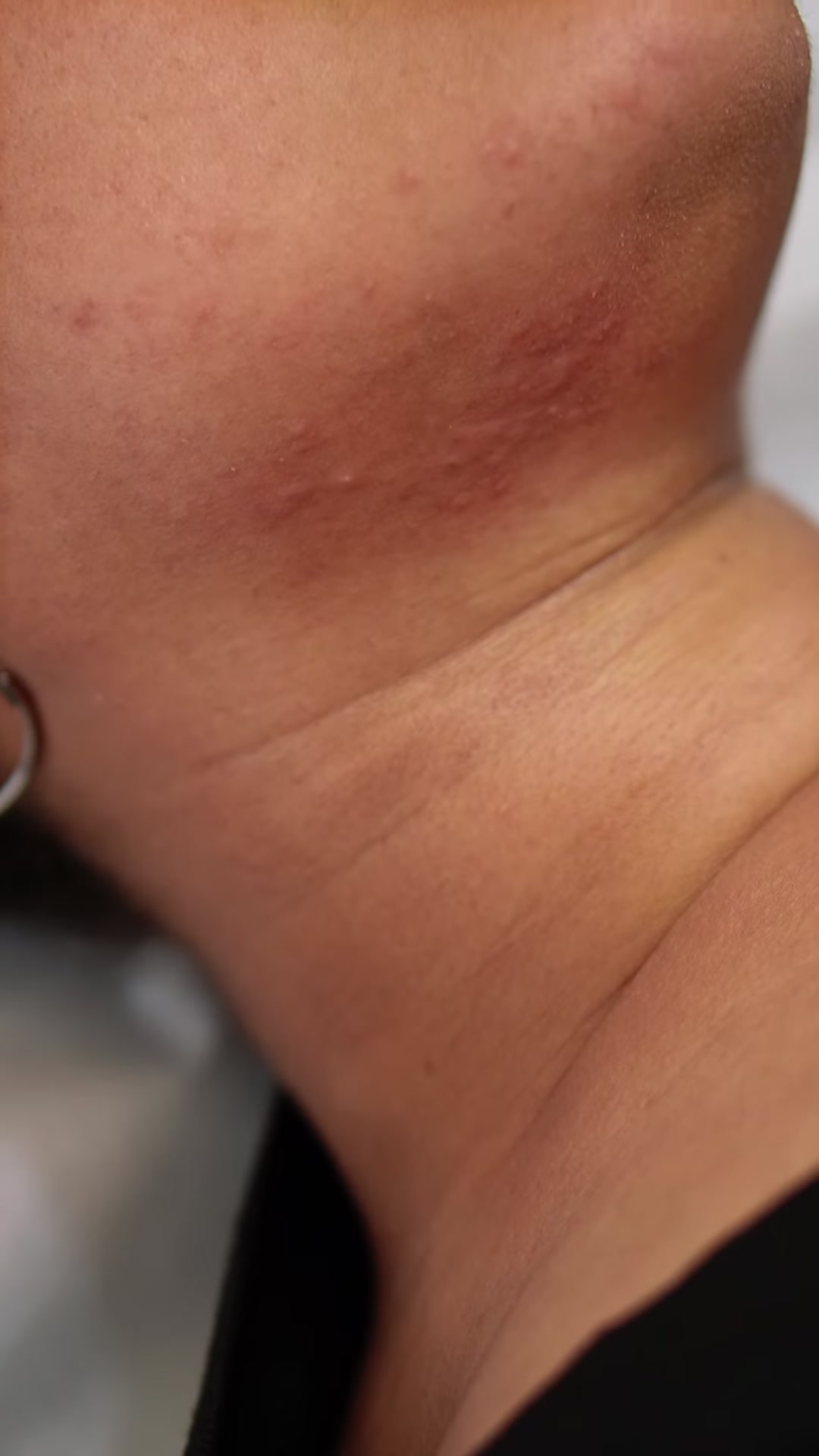 Vidéo Consultation prealable obligatoire chez HISHMA BEAUTY