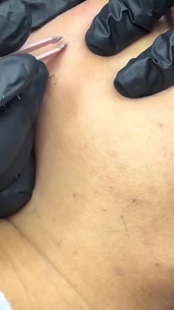 Vidéo Consultation prealable obligatoire chez HISHMA BEAUTY