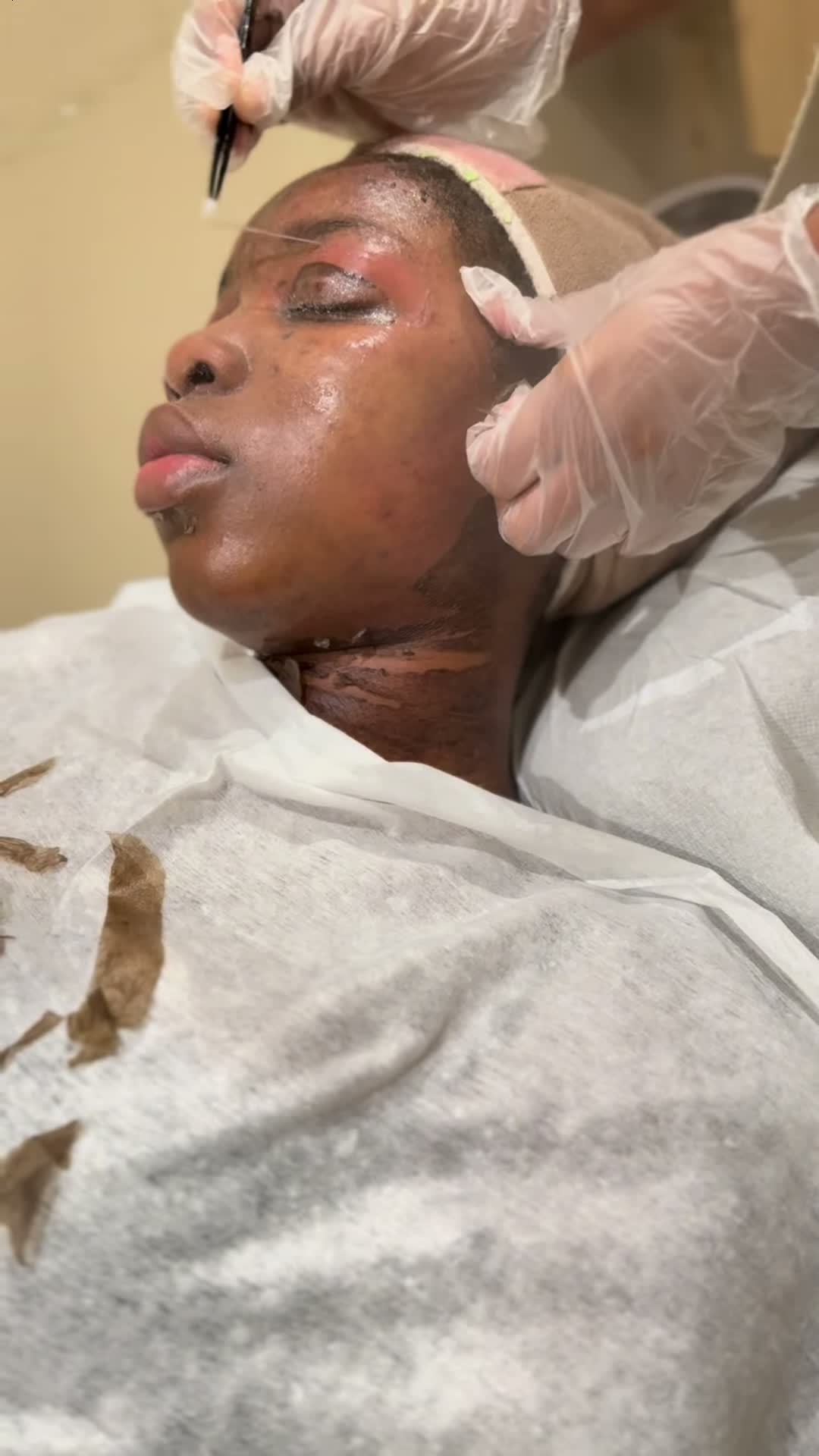 Vidéo Macro Peel chez ABD Beauty