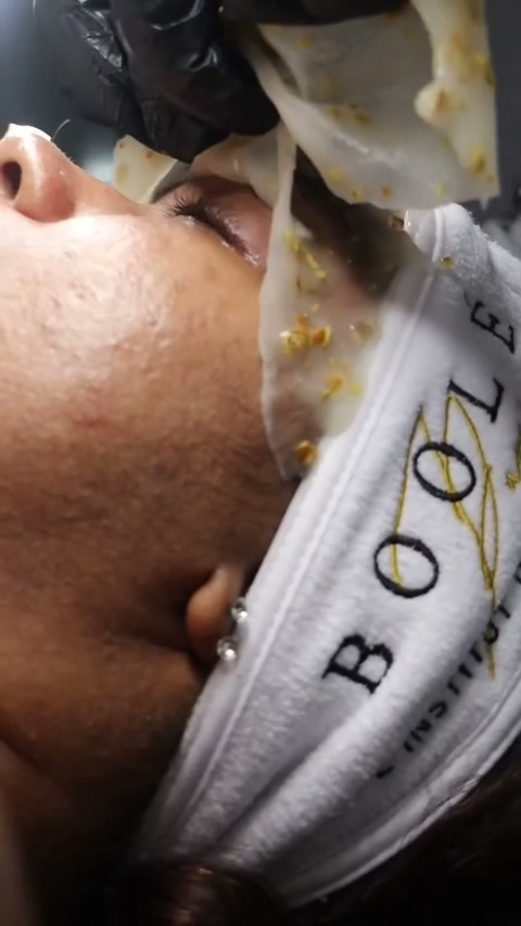 Vidéo Diagnostic de peau avec appareil + routine personnalisé chez Boole Paris