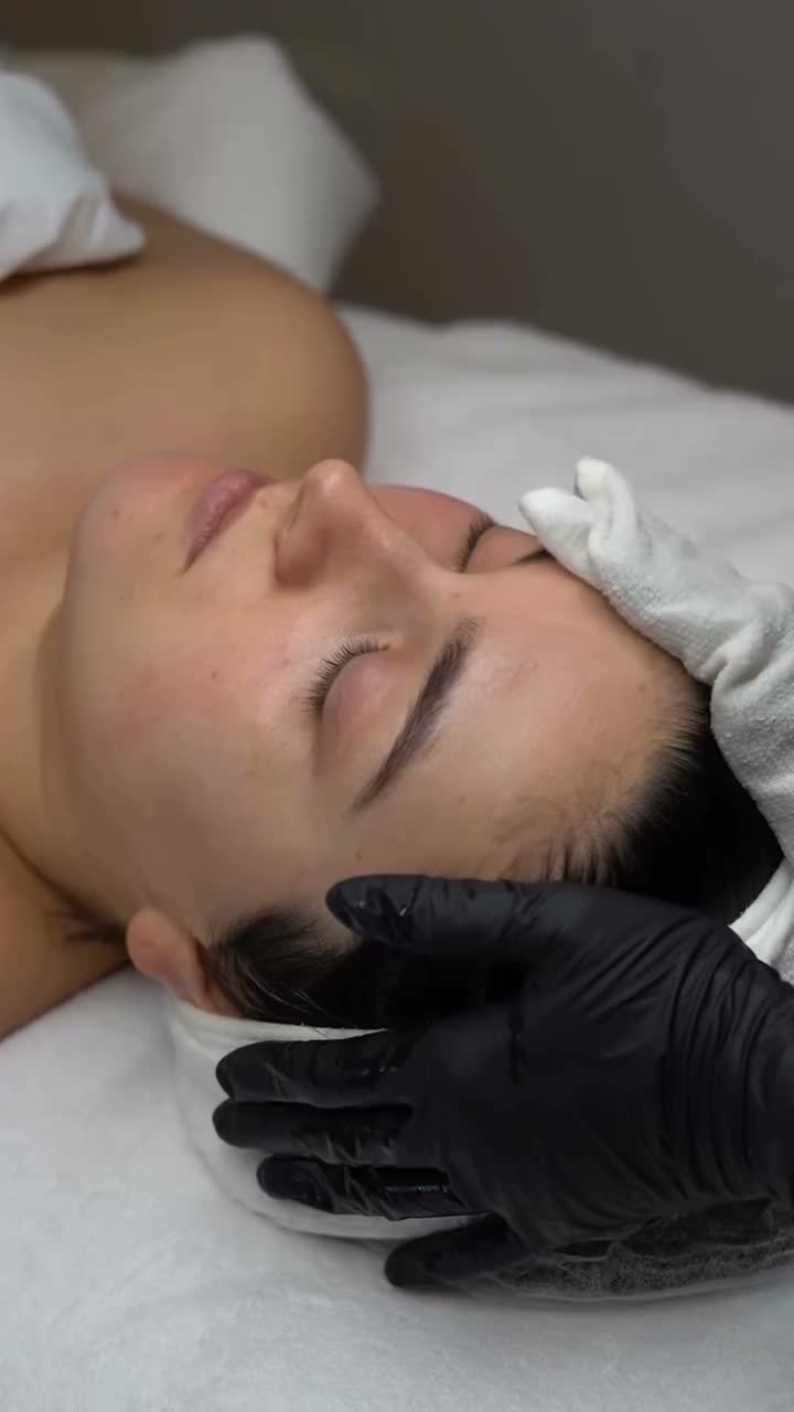 Vidéo Peeling Avancé 2.0 chez sacree paris esthetique