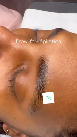 Vidéo Browlift chez Beaute Anto