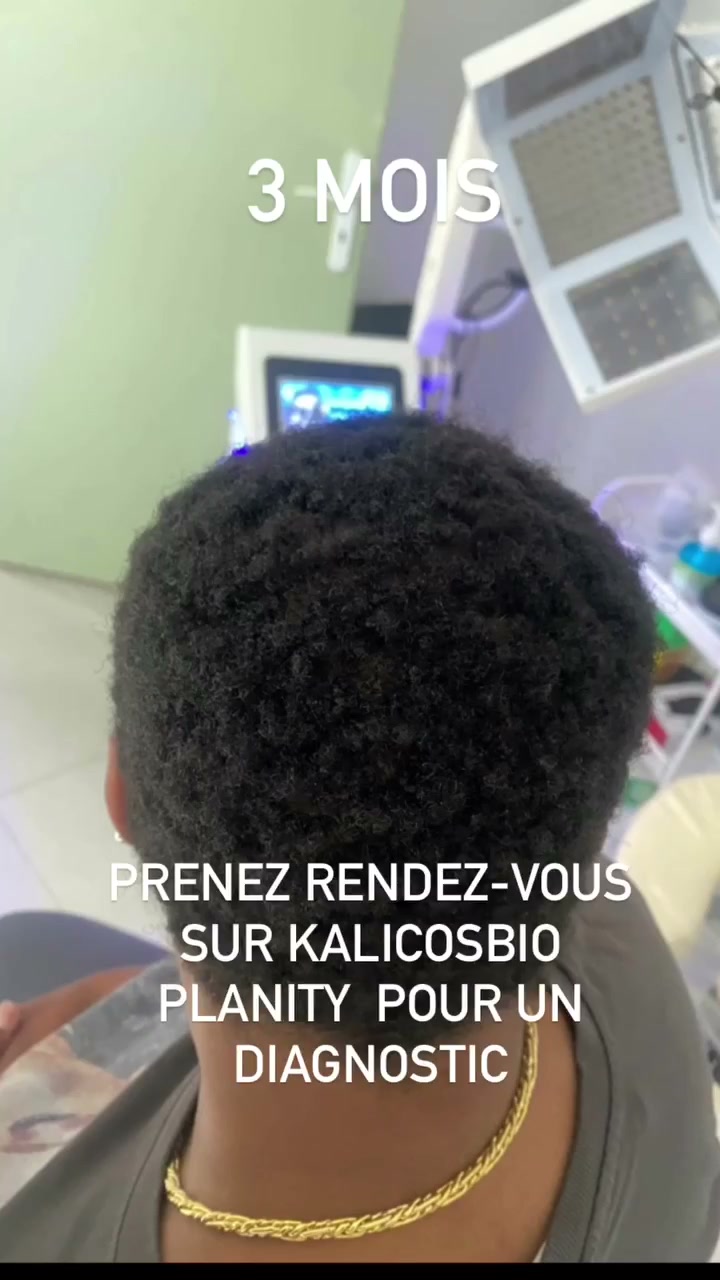 Vidéo Hairneedling tempes chez Kalicosbio