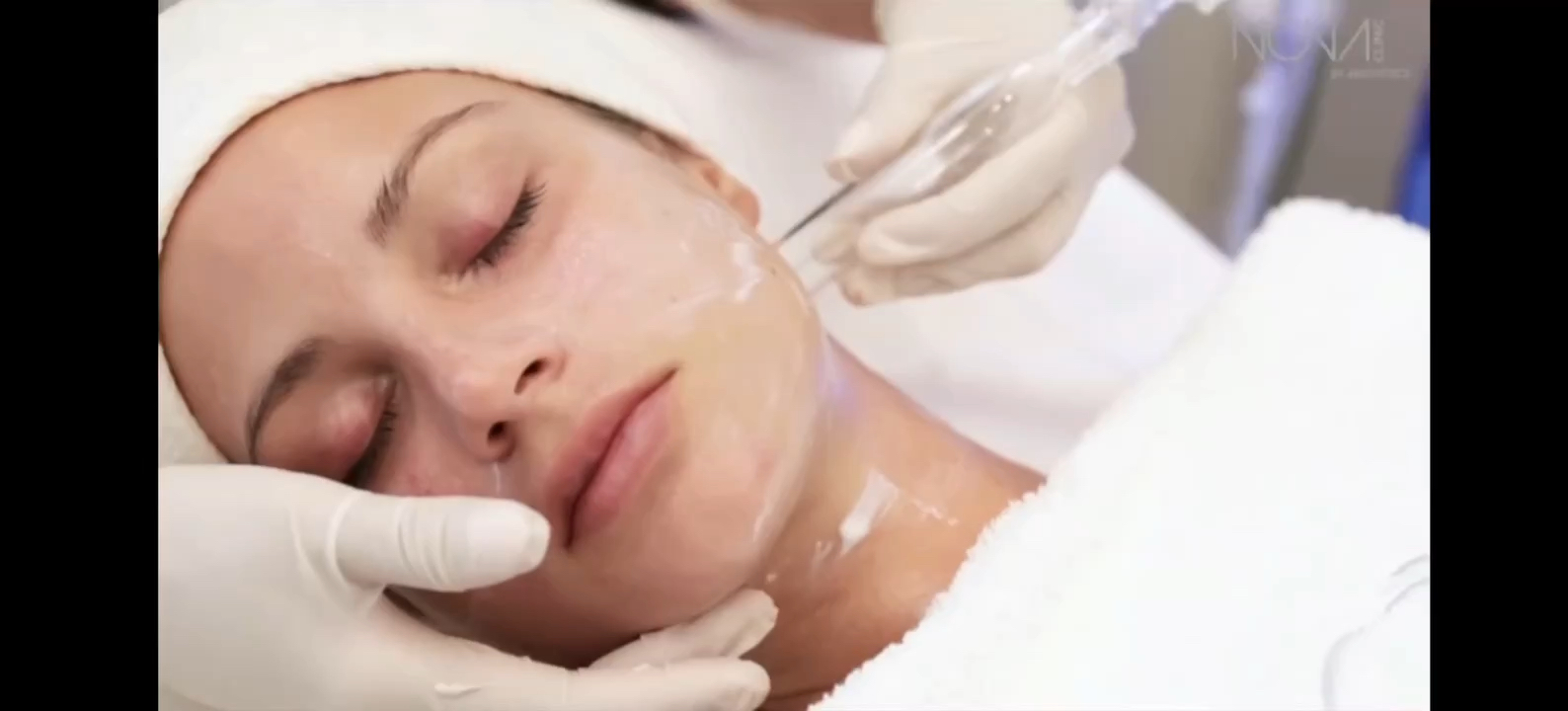 Vidéo 💦 𝐇𝐘𝐃𝐑𝐀𝐅𝐀𝐂𝐈𝐀𝐋® 𝐍𝐄𝐓𝐓𝐎𝐘𝐀𝐆𝐄 𝐏𝐑𝐎𝐅𝐎𝐍𝐃 𝐀 𝐋𝐀 𝐕𝐀𝐏𝐄𝐔𝐑 + Masque Hyaluronique + Luminothérapie chez CASA DE LA BEAUTÉ