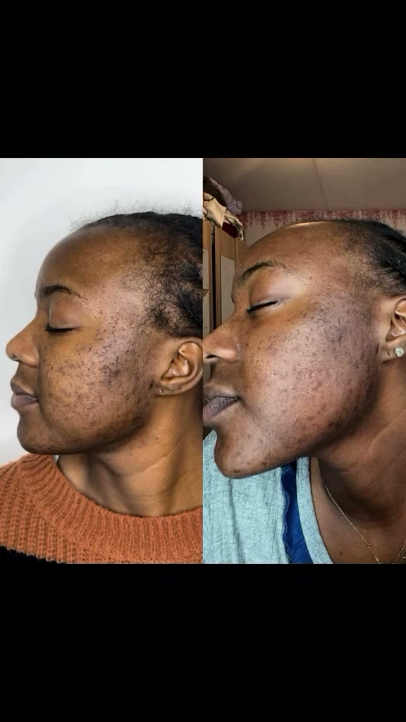 Vidéo Peeling aux algues visage chez DJENNA K INSTITUT