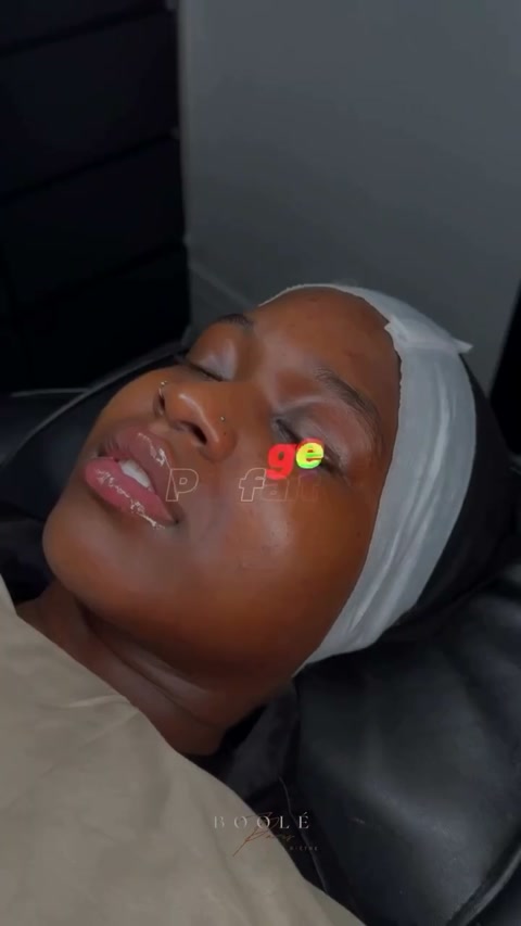 Vidéo Derma chez Boole Paris