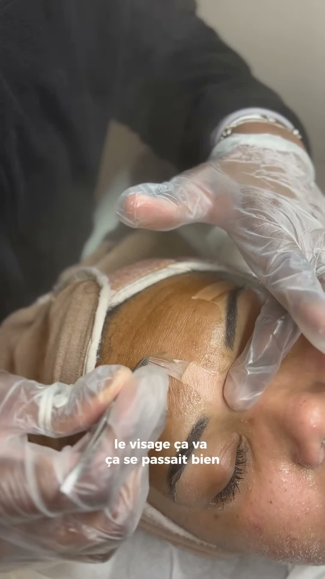 Vidéo Macro Peel chez ABD Beauty